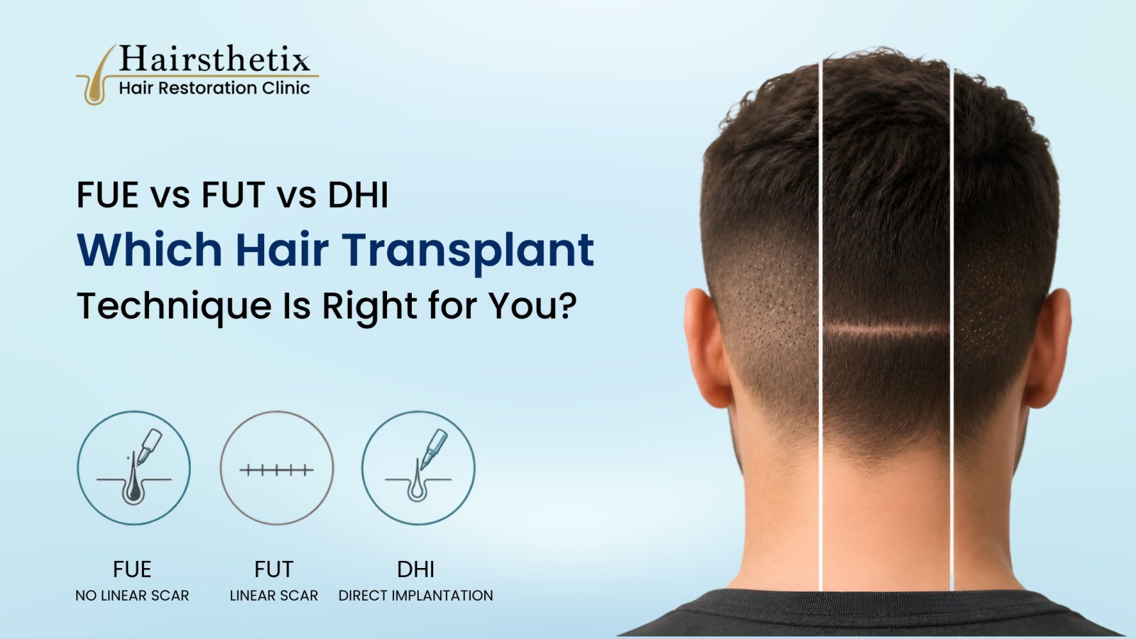 FUE vs FUT vs DHI hair transplant techniques compared