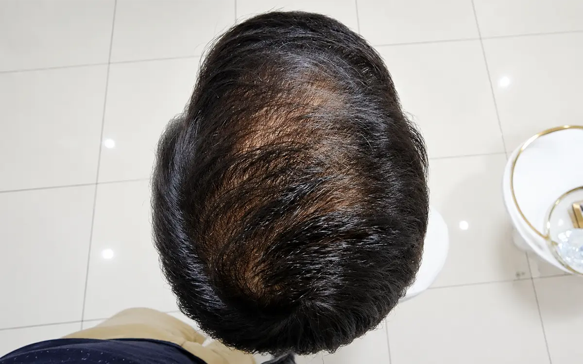After