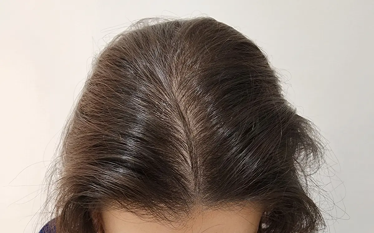 After