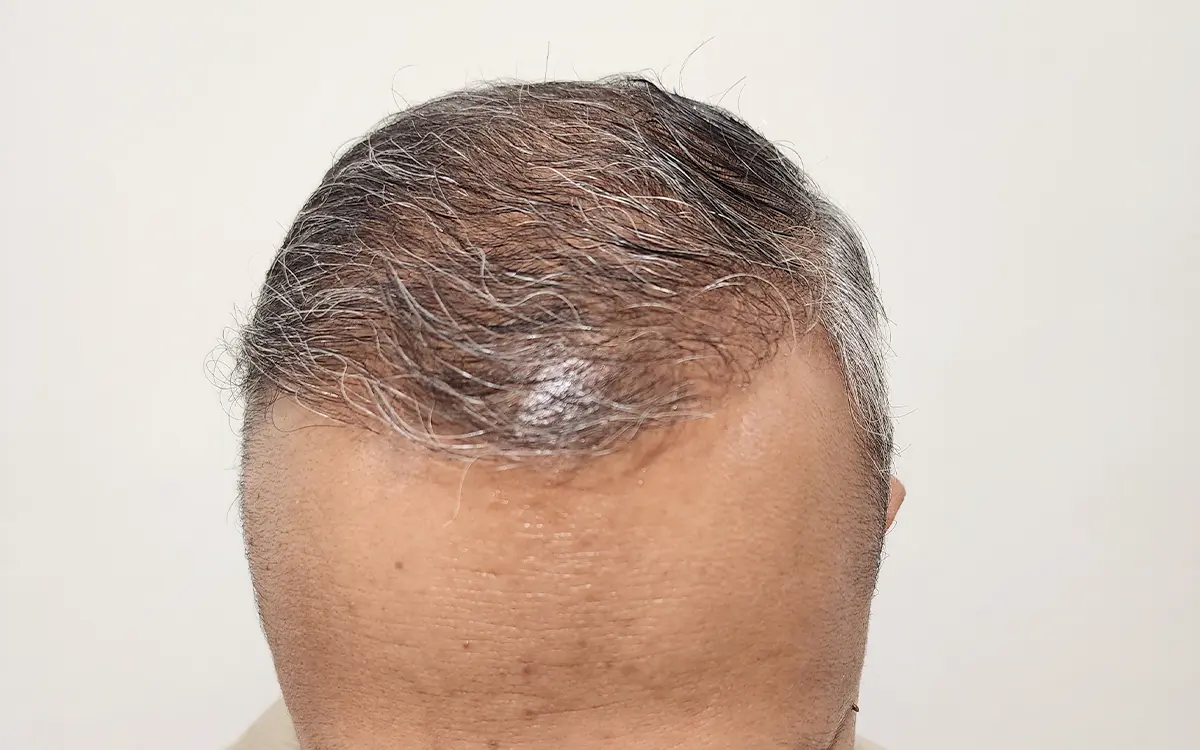 After