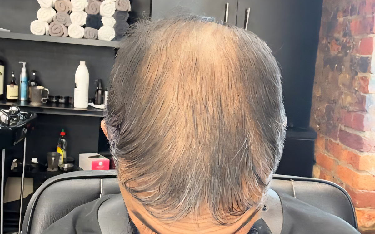 Before