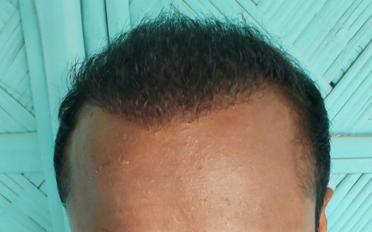After