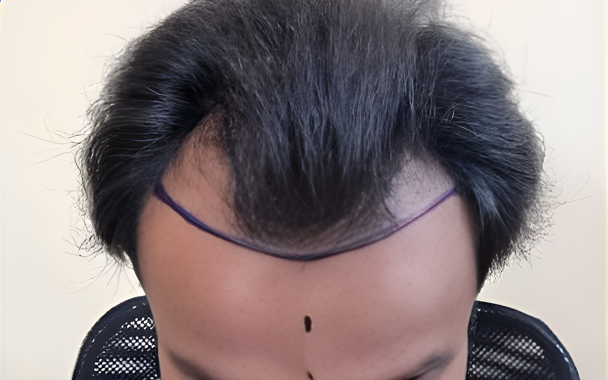 Before