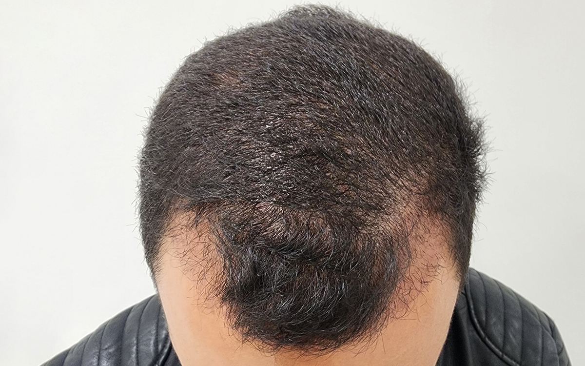 Before