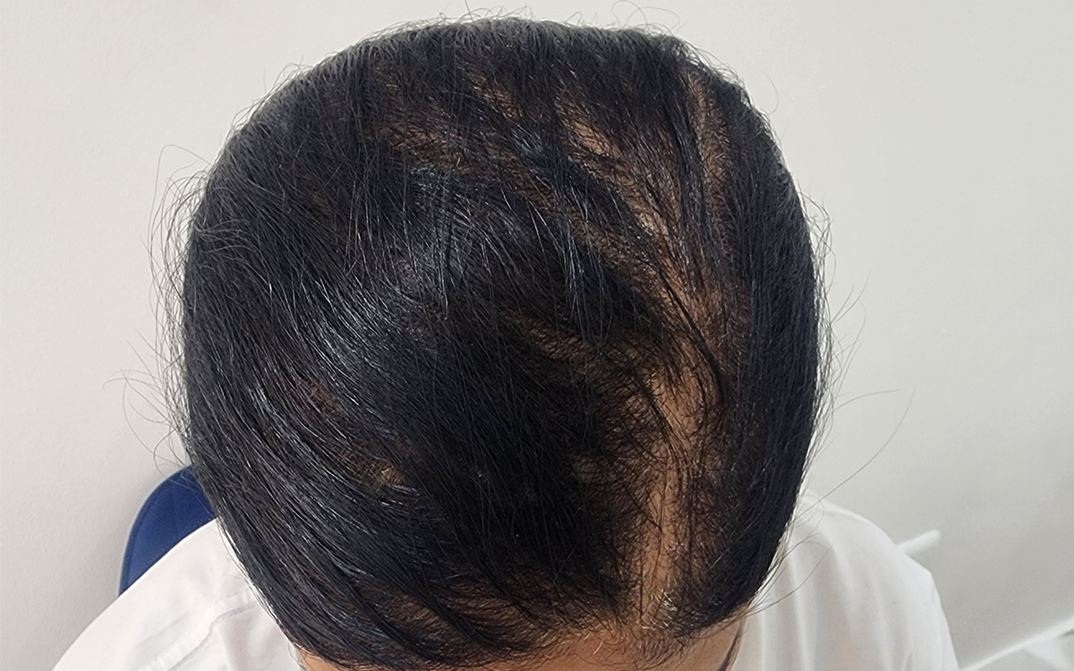 After