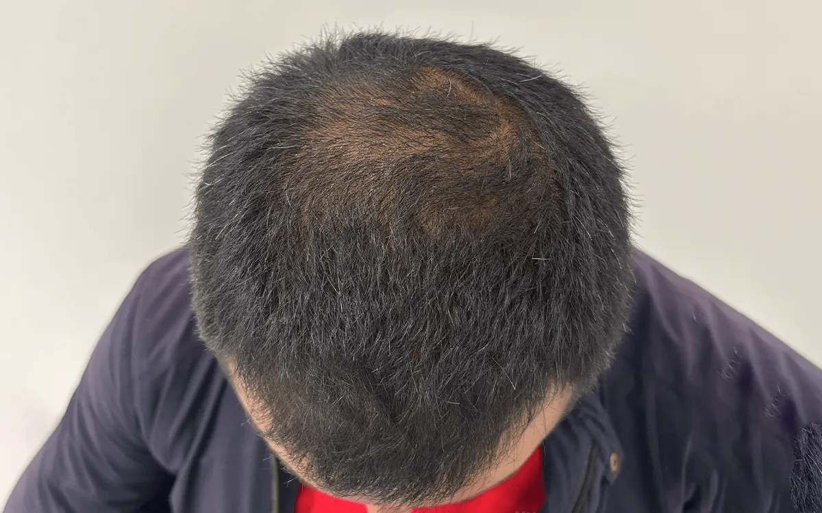 After