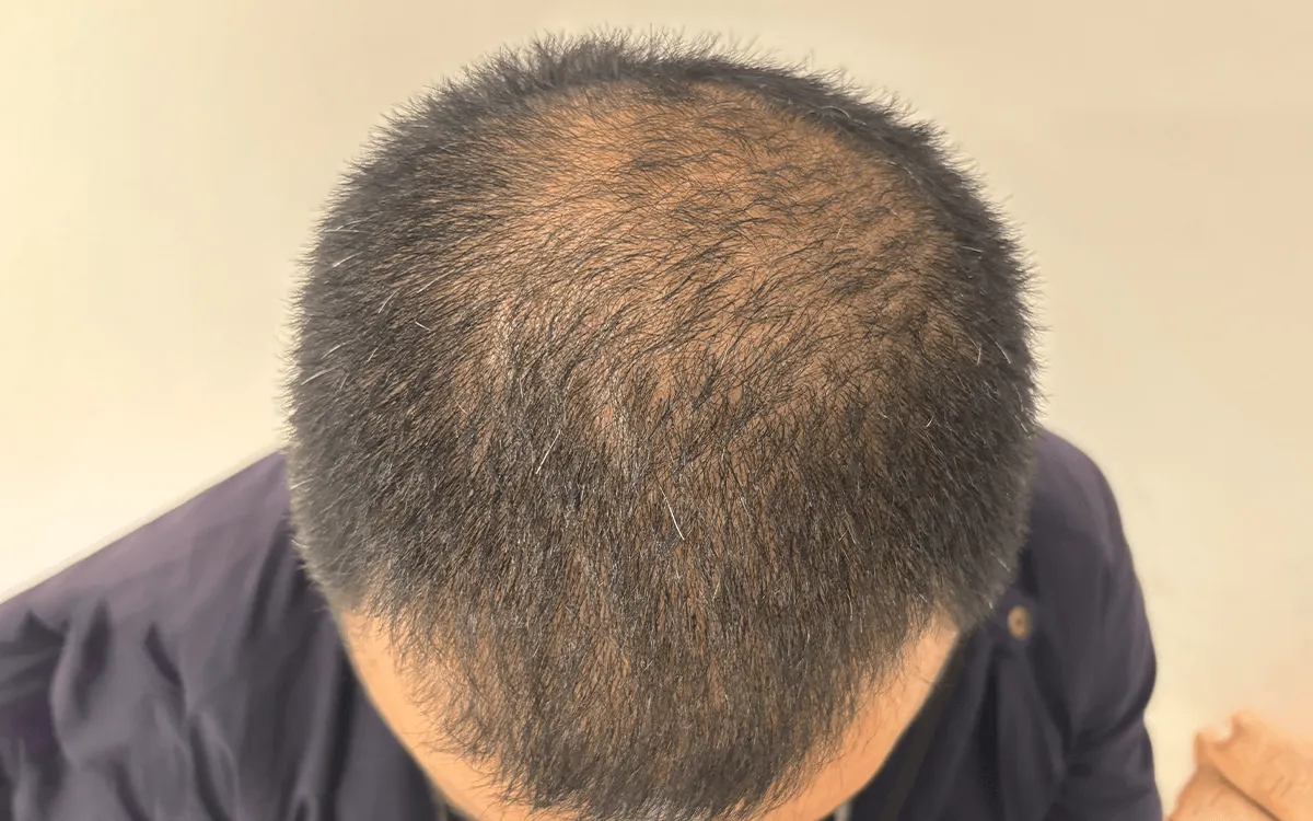 Before