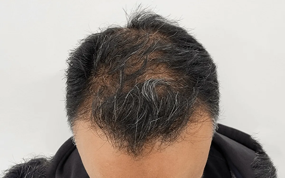 Before