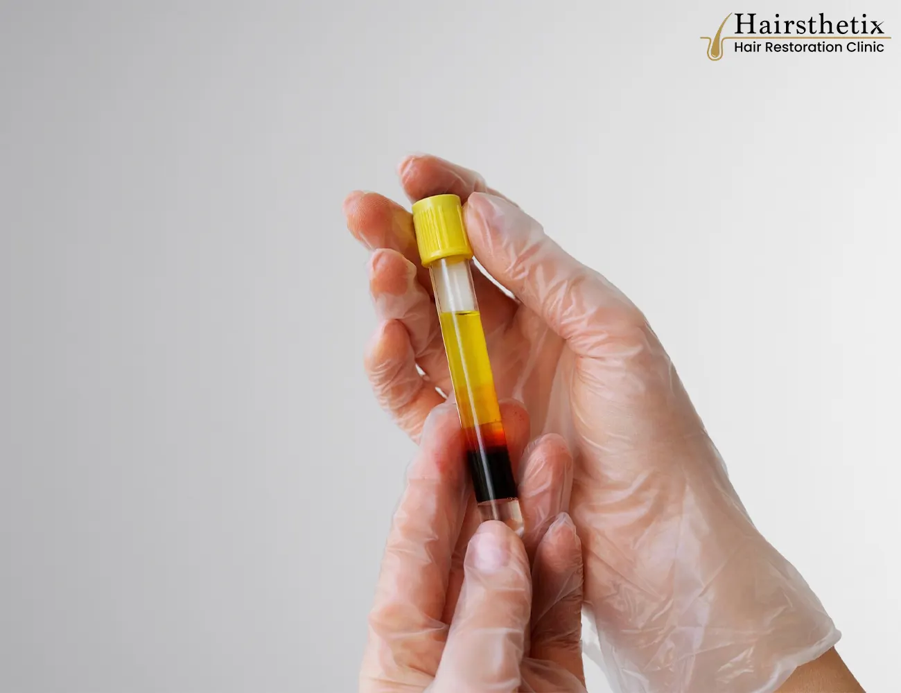 PRP Therapy procedure